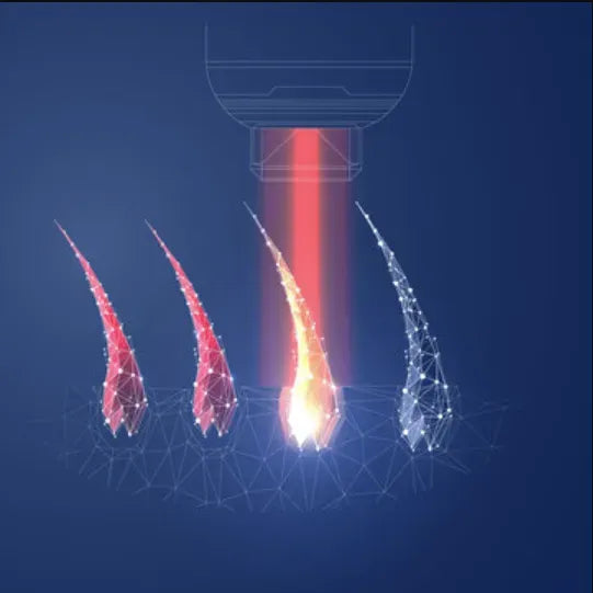 Illustration d’un appareil d’épilation ciblant les follicules pileux sur fond bleu
